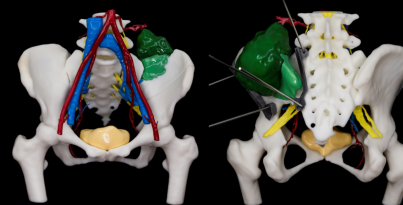 最快仅需20分钟，解密“华西造”智能3D医疗高速打印系统